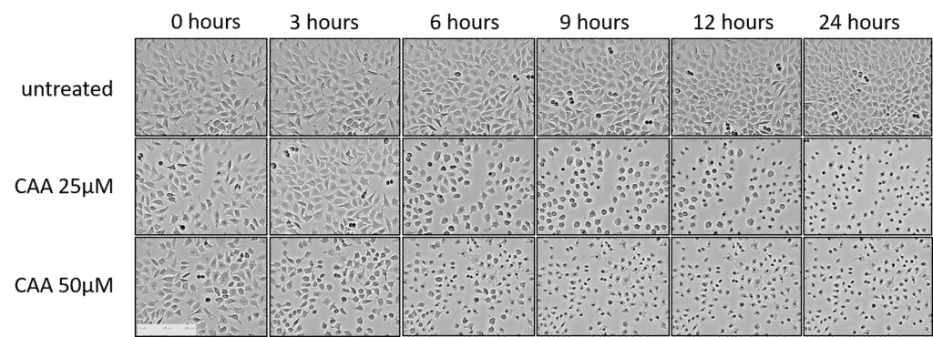 CAA Effects on Cell Morphology