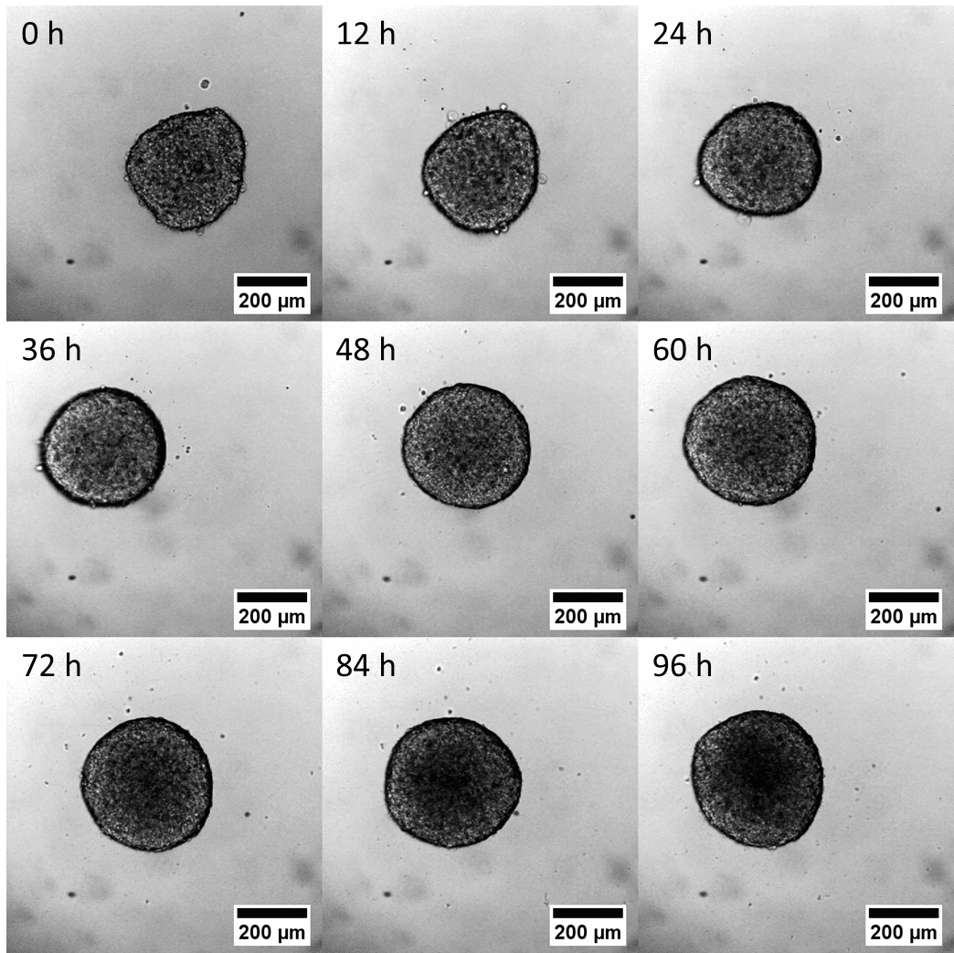 Cellular spheroid with migrating cell monolayer — brightfield timelapse image captured with zenCELL owl