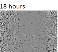 18hours