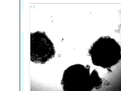 Koala oocyte imaged with zenCELL owl IVF software — brightfield live cell imaging